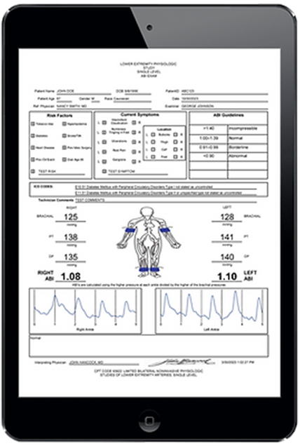 Newman Medical simpleABI single level ABI report displayed on a tablet