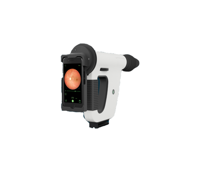 Handheld Fundus Camera - Retinal Imaging