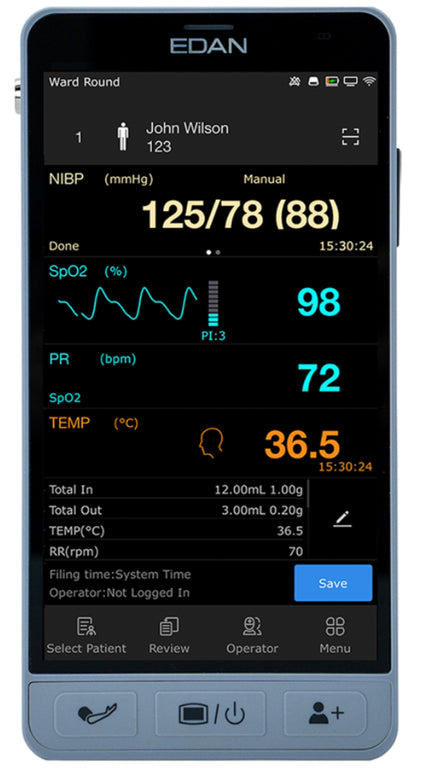 Edan iM3s Handheld Vital Signs Monitor.