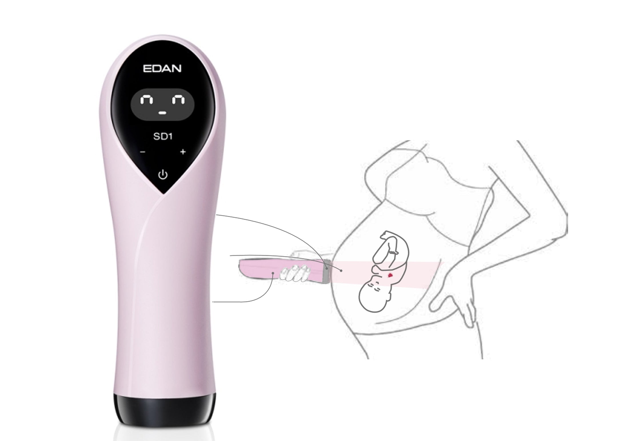 Edan All in One Ultrasonic Pocket Doppler.