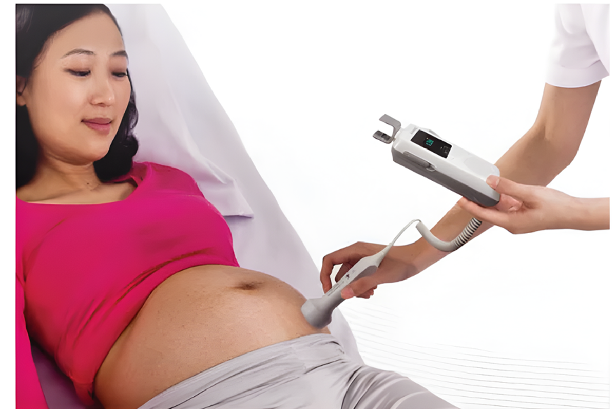Edan Ultrasonic Pocket Fetal Doppler.