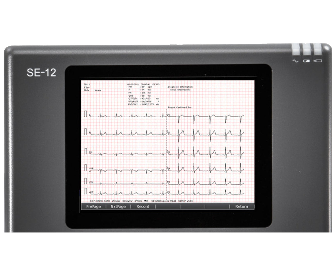 Edan Express 12-Channel ECG Machine