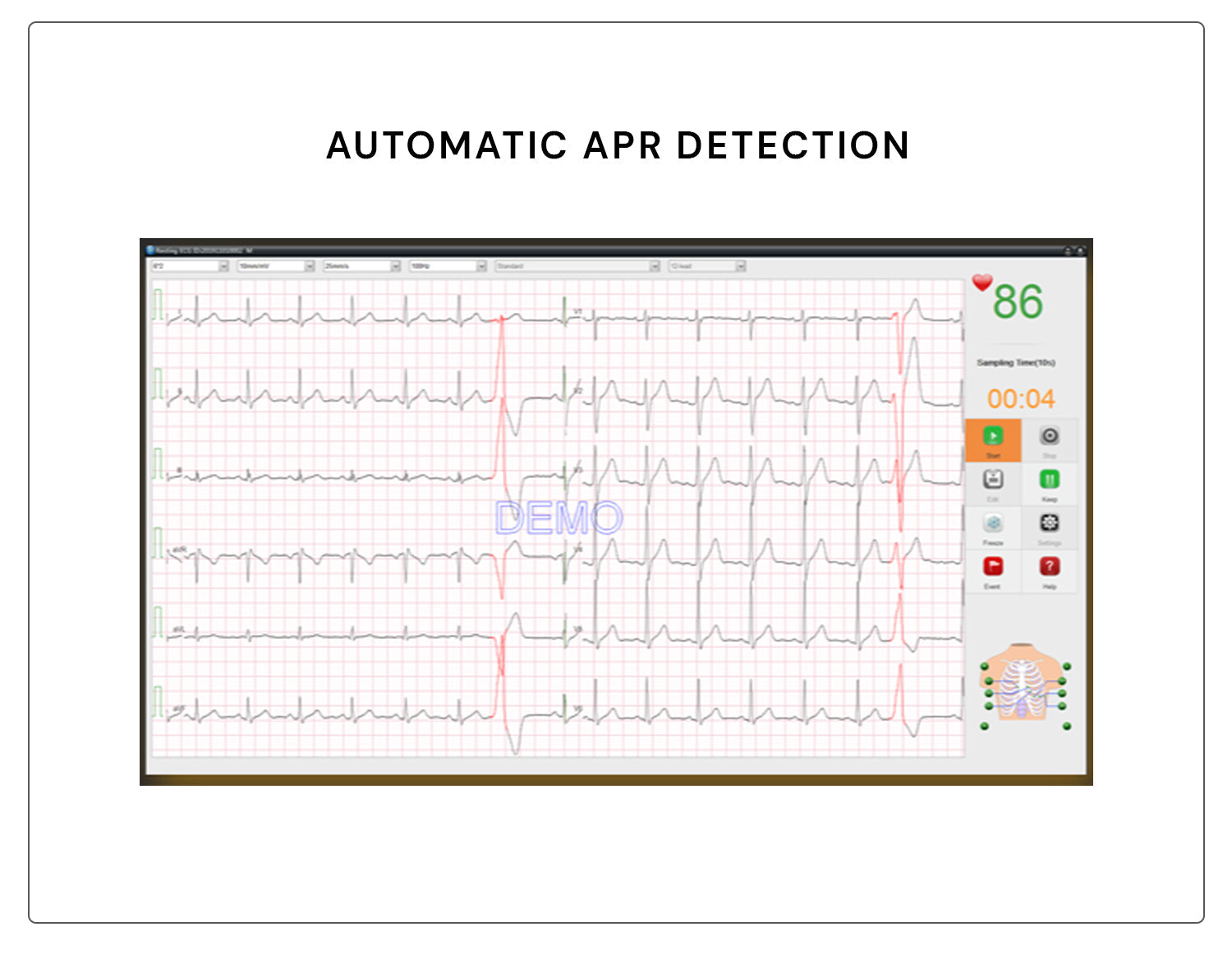 Edan PC Based Wired ECG Sampling Box