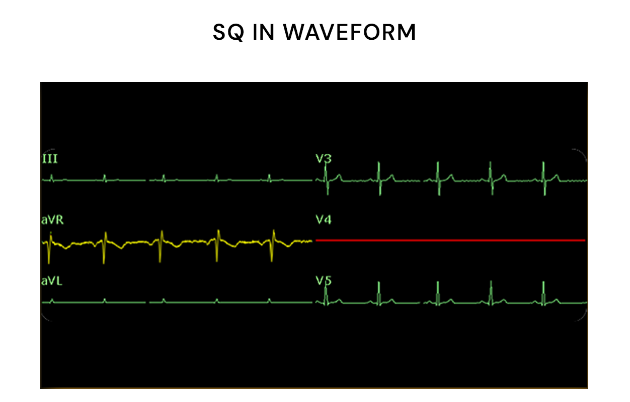 Edan PC Based Wired ECG Sampling Box
