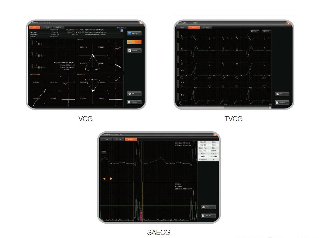 Edan Resting ECG System