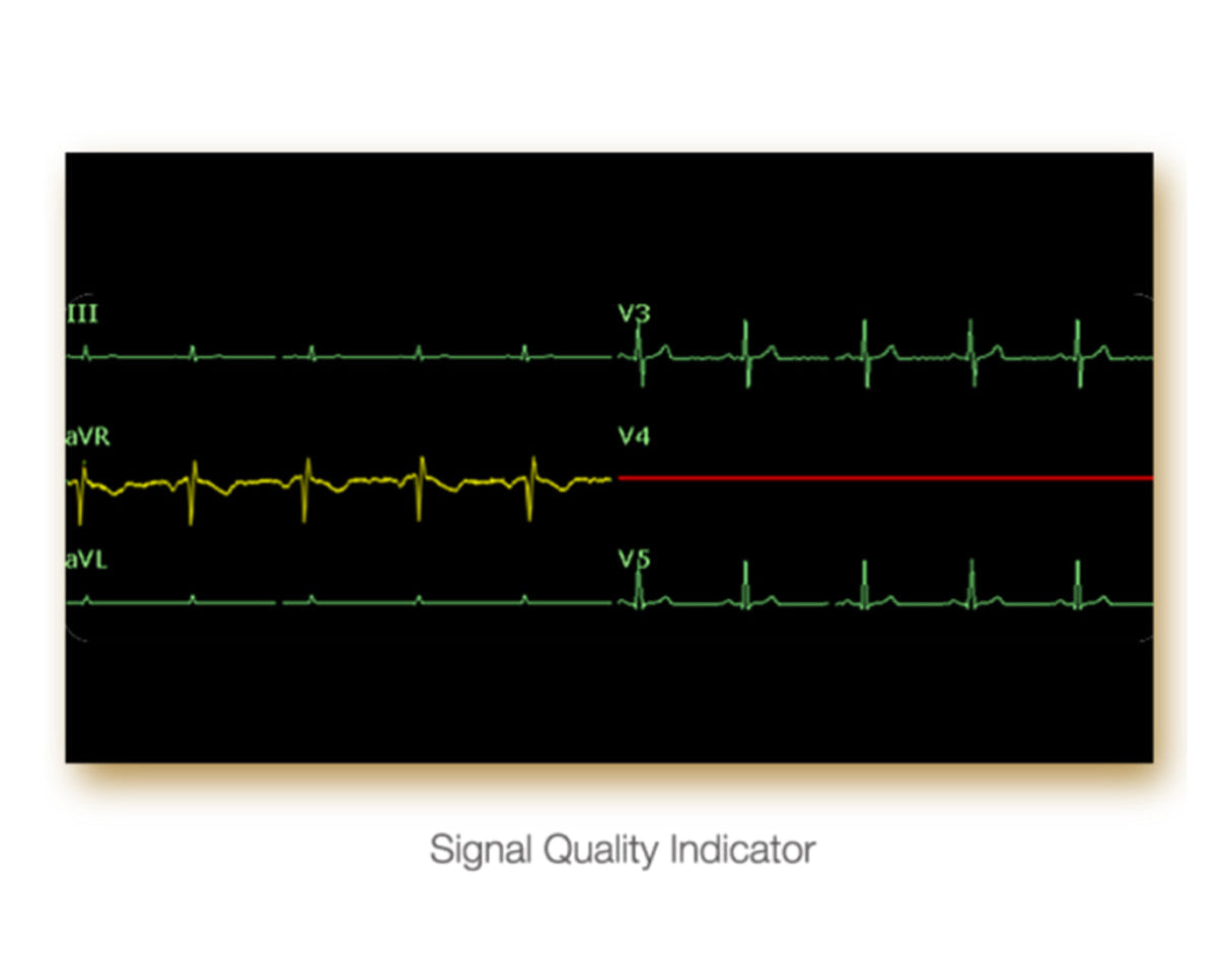 Edan 3-Channel Resting ECG System