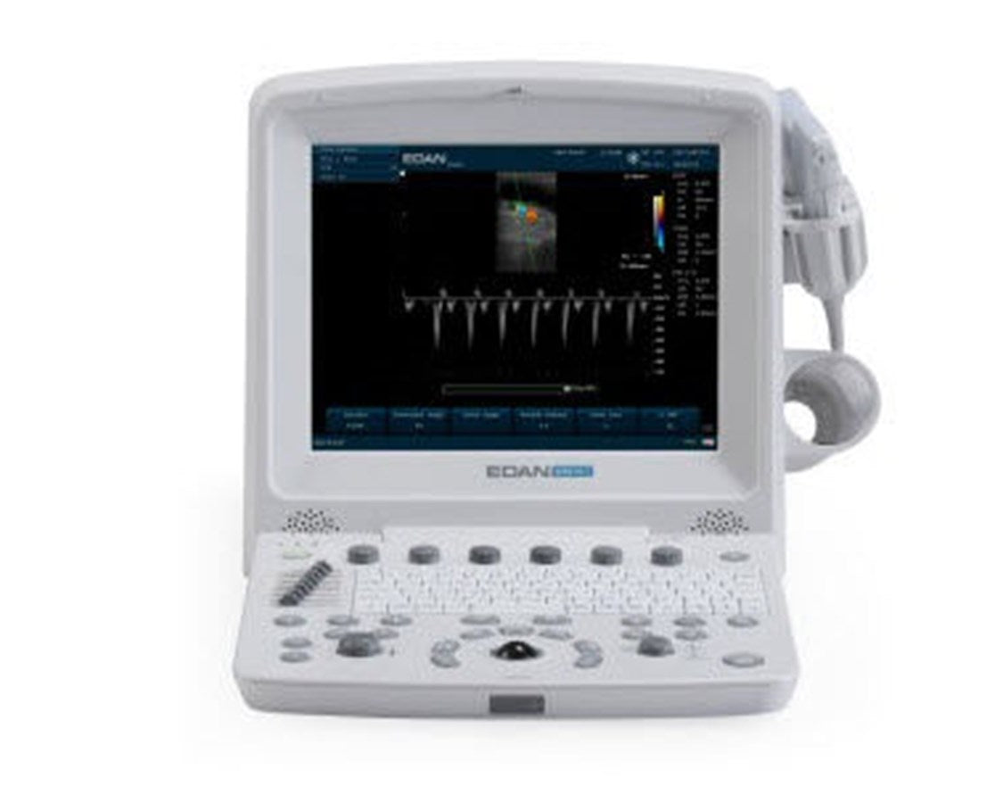 Edan Prime Diagnostic Ultrasound.