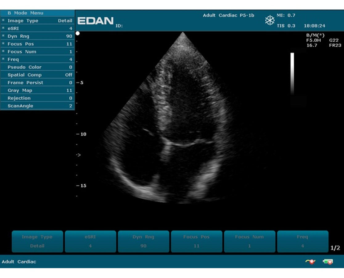 Edan Prime Diagnostic Ultrasound.