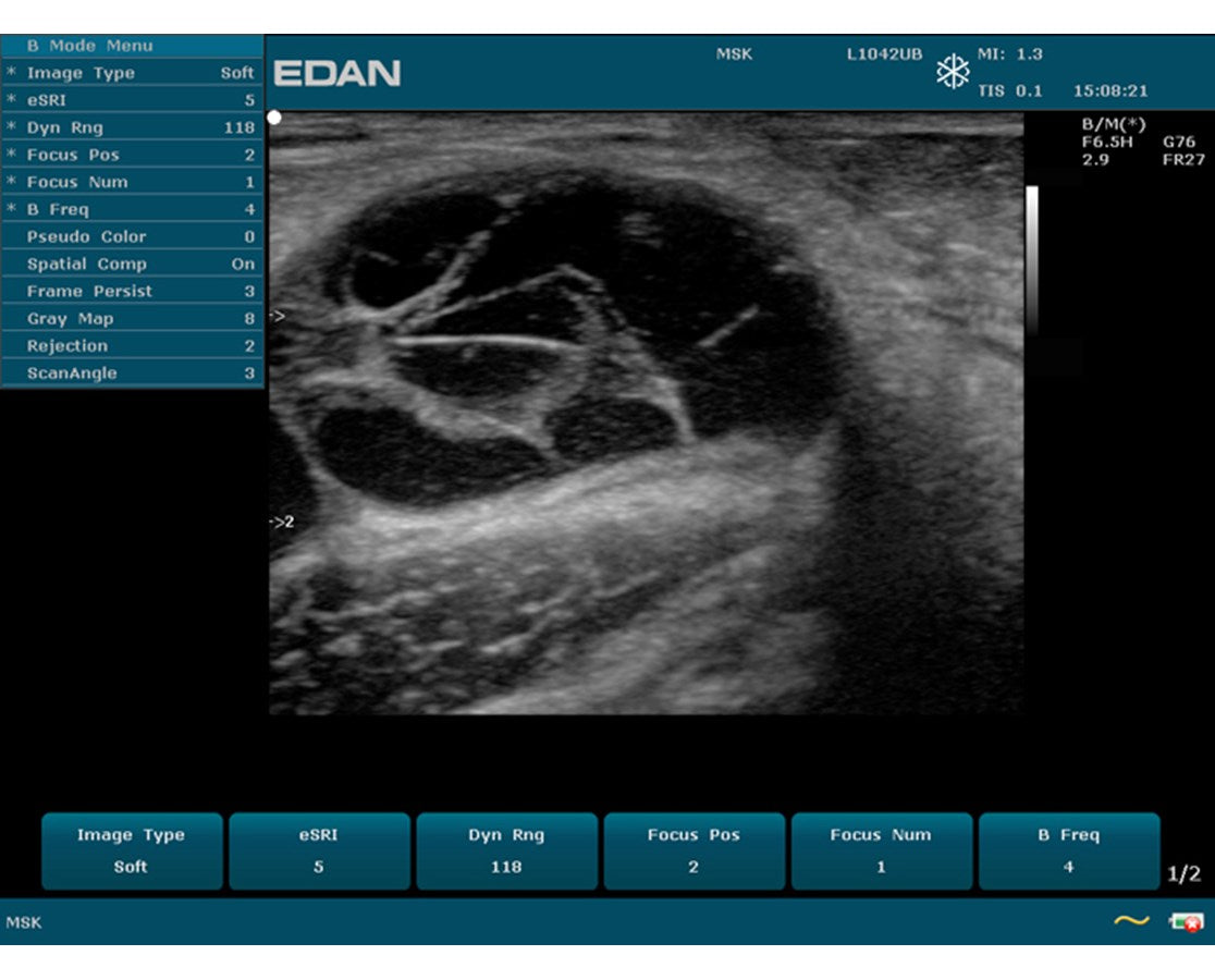 Edan Prime Diagnostic Ultrasound.