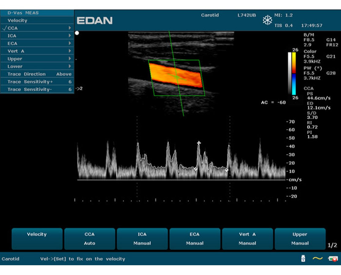Edan Prime Diagnostic Ultrasound.