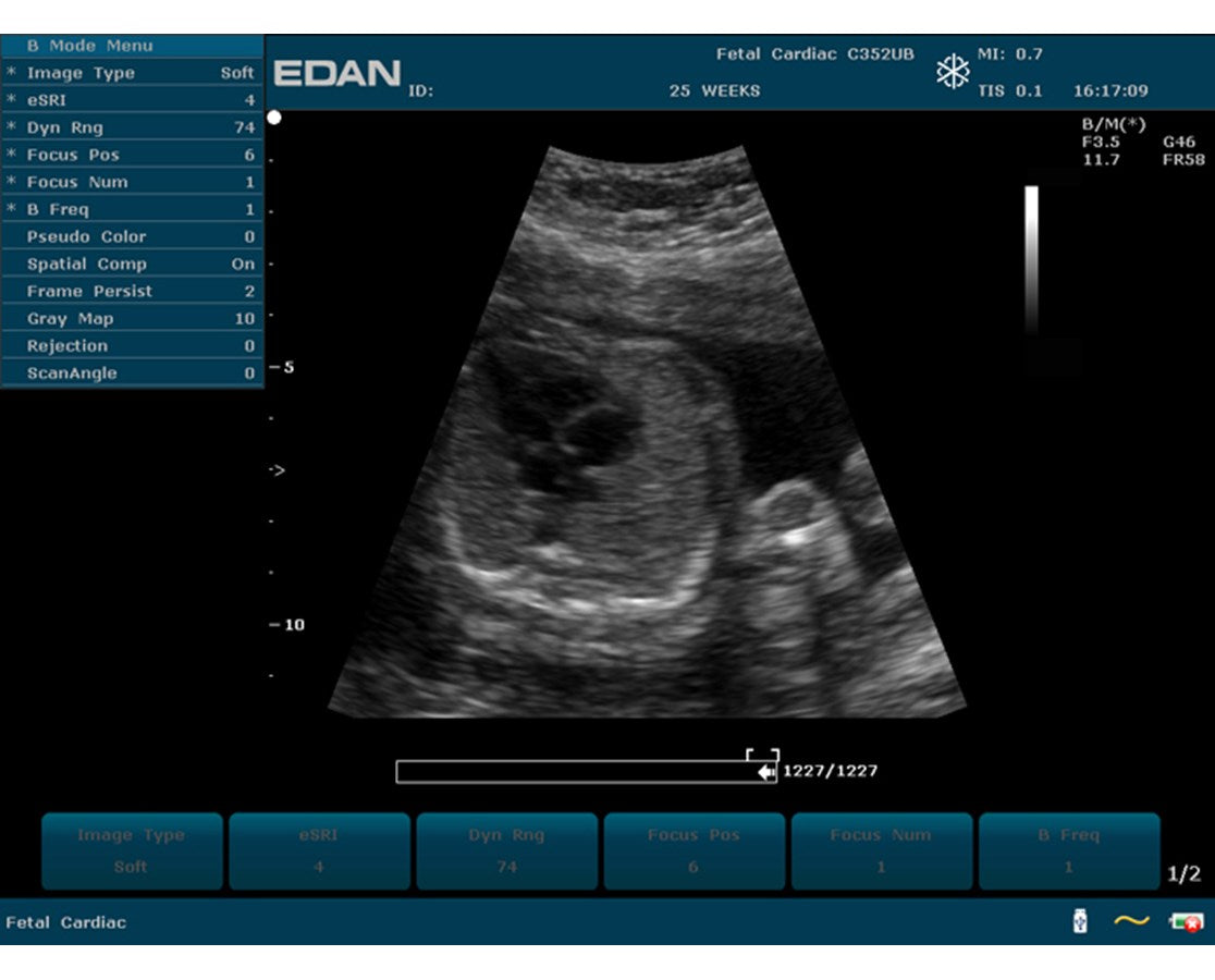 Edan Prime Diagnostic Ultrasound.