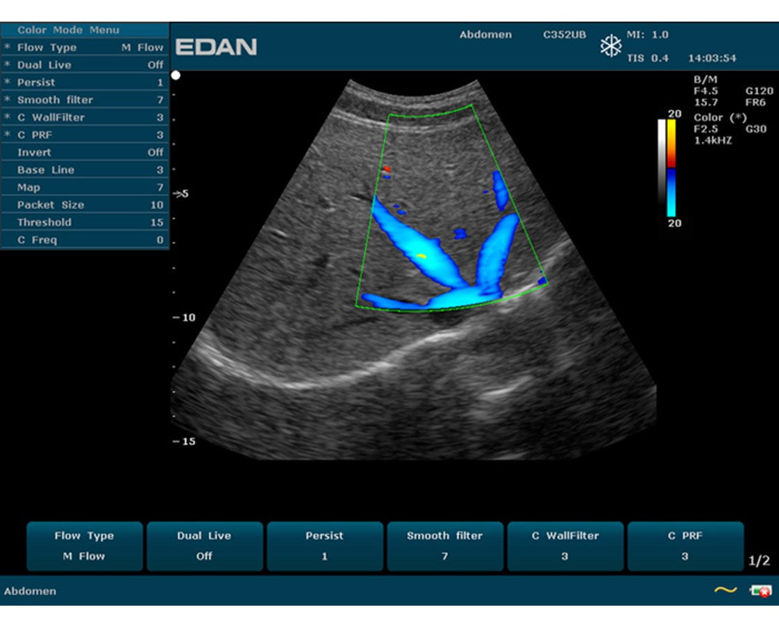 Edan Prime Diagnostic Ultrasound.