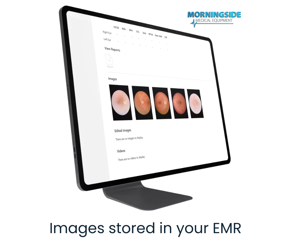 Handheld Fundus Camera - Retinal Imaging