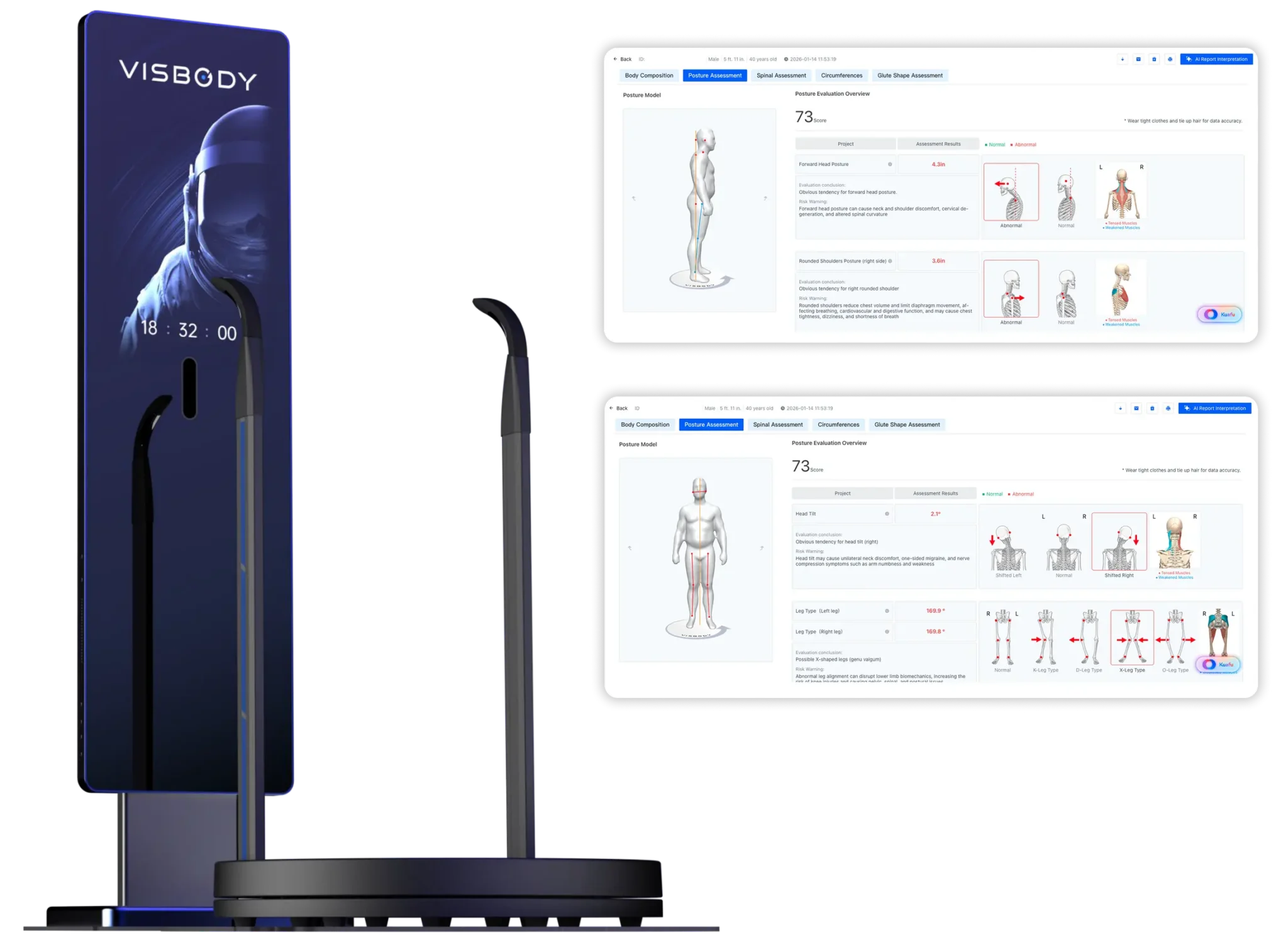Visbody 3D body scanning device with software screenshots showing body composition analysis and muscle mapping results