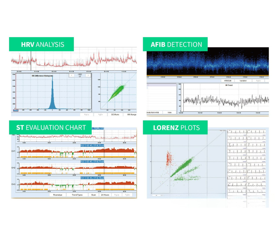 Edan Digital Holter Analysis System