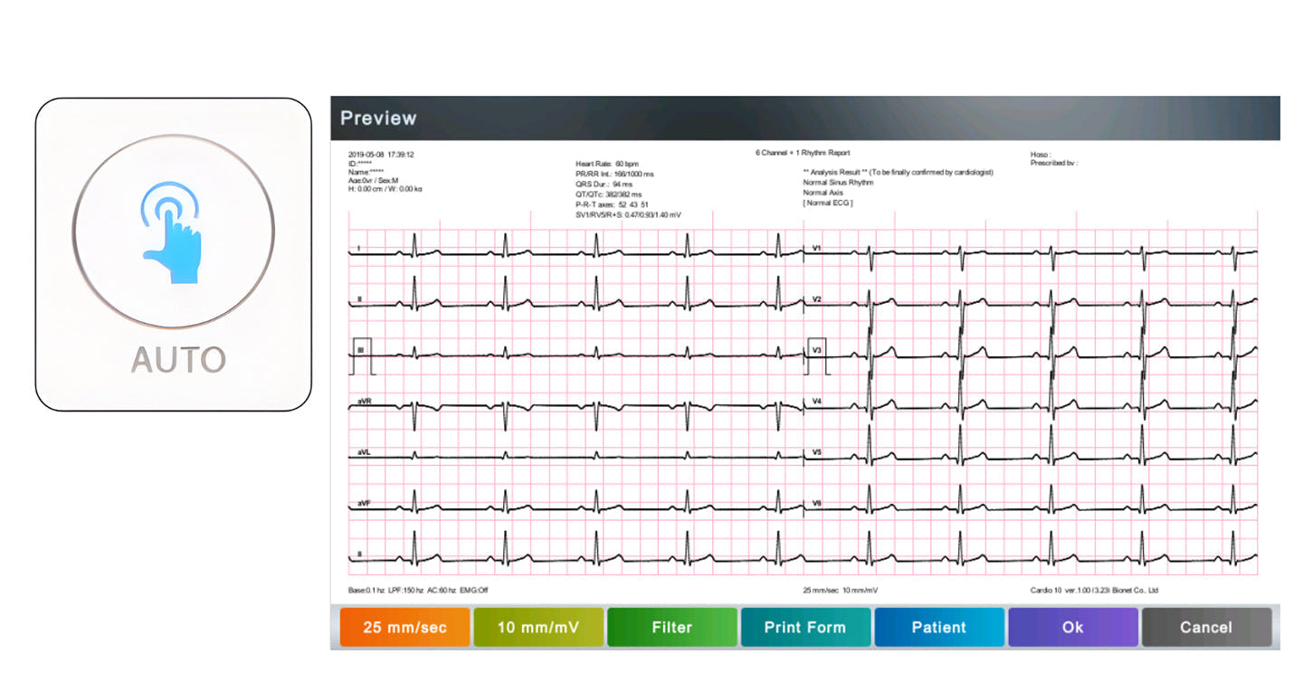 MDPro Guardian 12-Channel Resting ECG. 