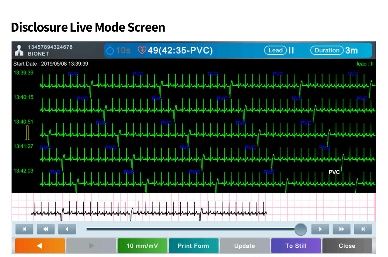 MDPro Guardian 12-Channel Resting ECG. 