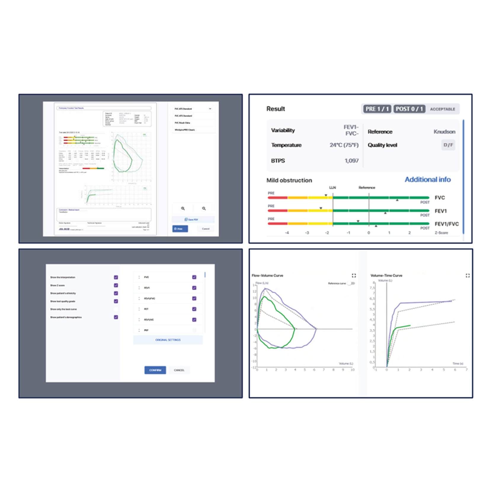 MIR Minispir Handheld USB Spirometer.