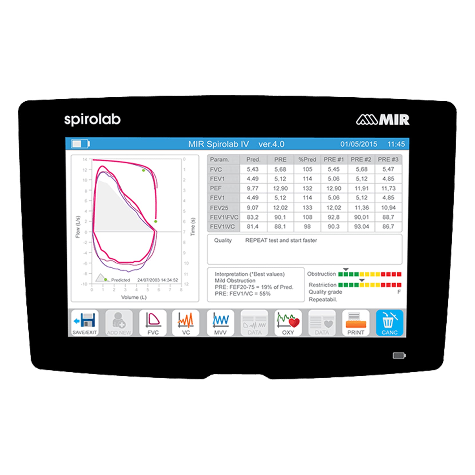 MIR Spirolab Desktop Spirometer.