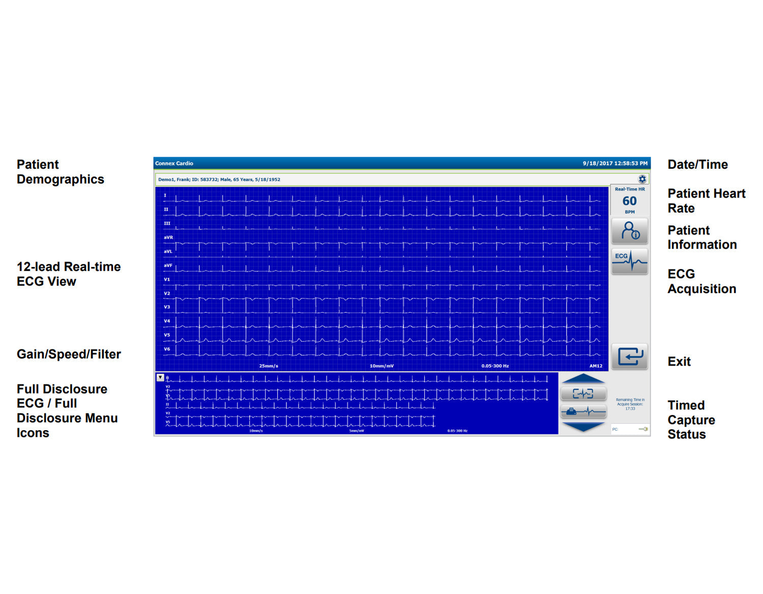 Welch Allyn Connex Cardio ECG