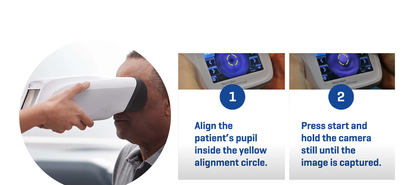 Welch Allyn RetinaVue Handheld Vision Screener.