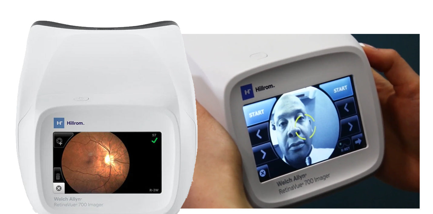 Welch Allyn RetinaVue Handheld Vision Screener.