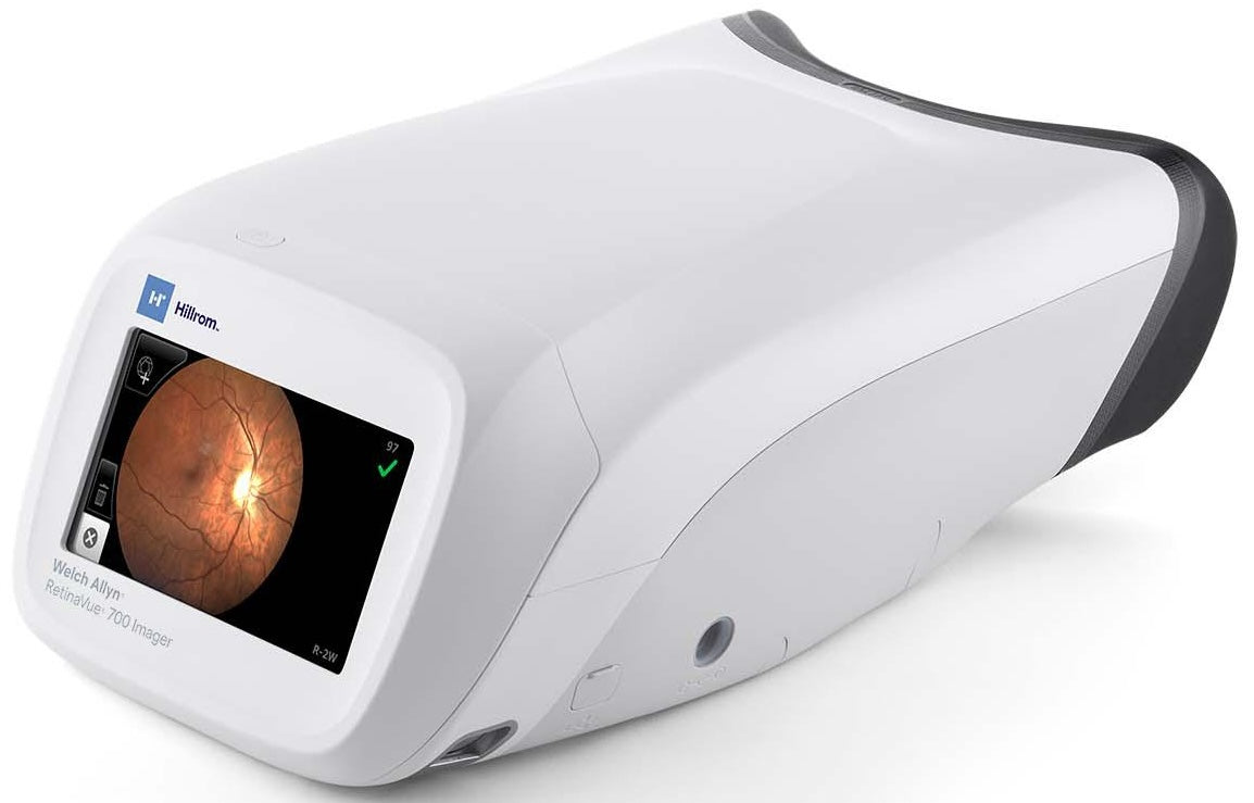 Welch Allyn RetinaVue Handheld Vision Screener.