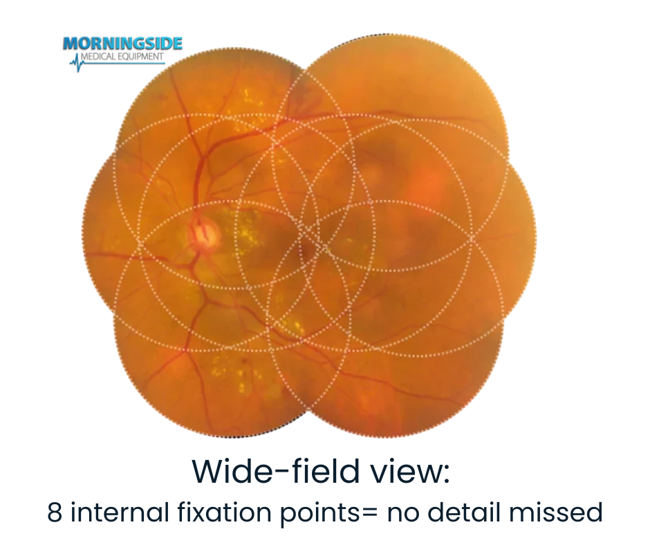 Handheld Fundus Camera - Retinal Imaging