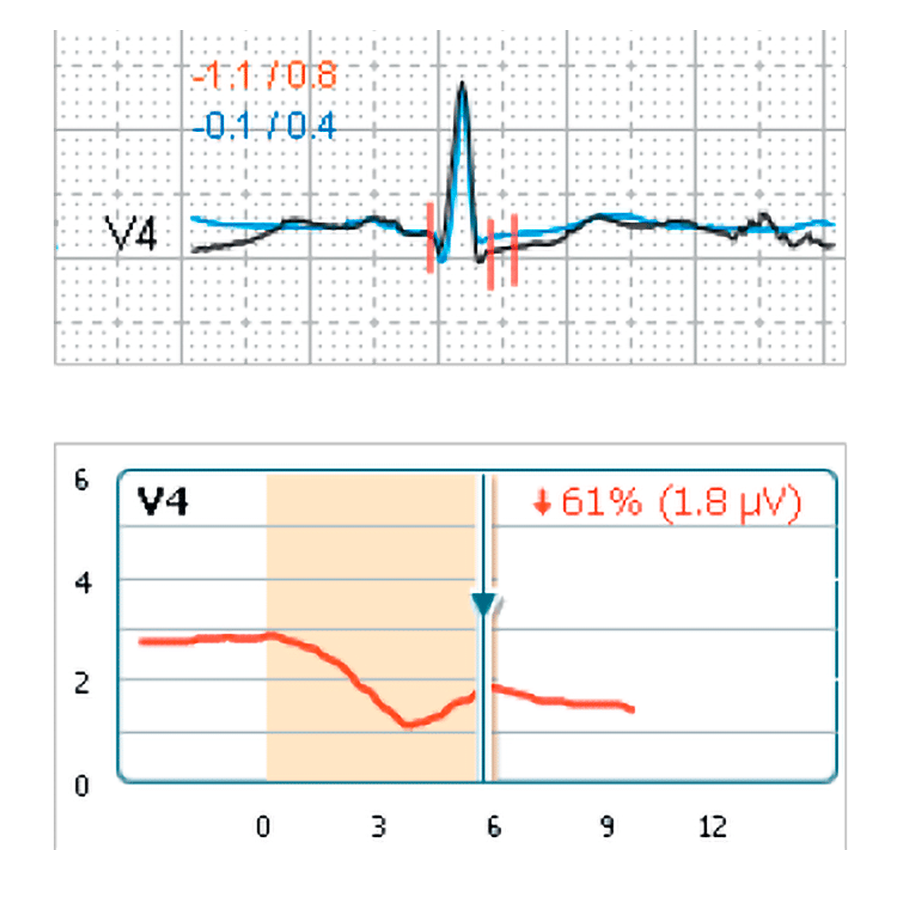 Schiller Cardiovit CS-200 Excellence