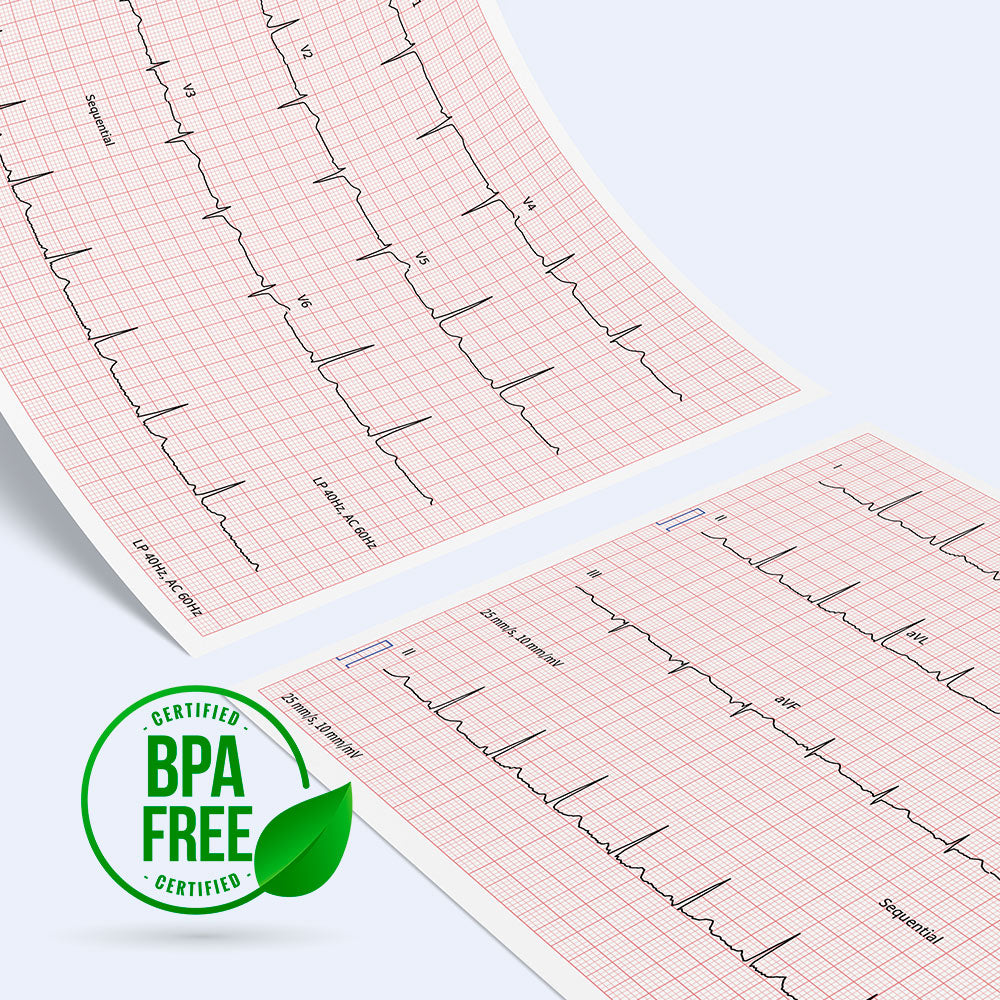 Schiller Cardiovit FT-1 EKG System