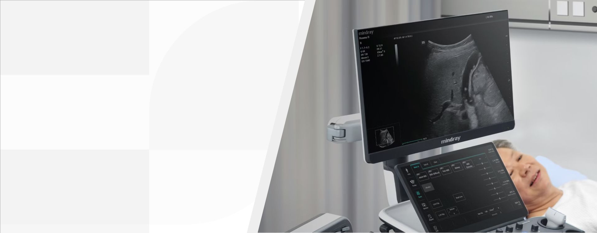 Resona I9 Ultrasound Machine.