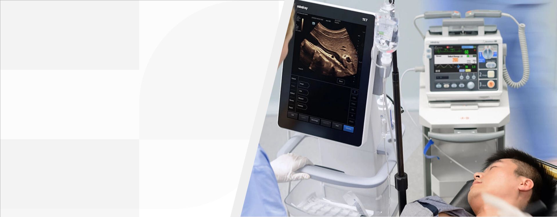 TE7 Ultrasound System.