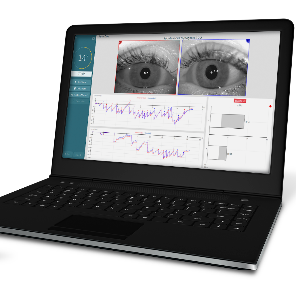Vertigo Testing Machine Vestibular Testing – Morningside Medical Equipment