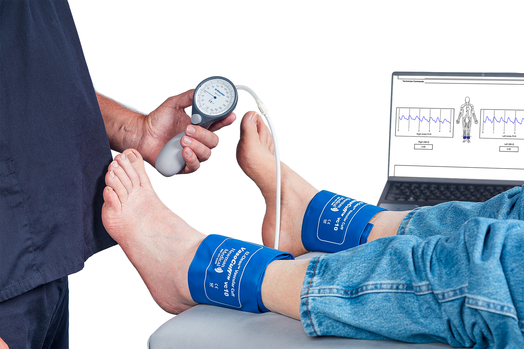 Newman Medical simpleABI-Q rapid PAD screening report