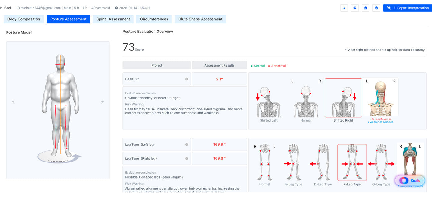 Body composition analysis software interface with a 3D human model and evaluation results.